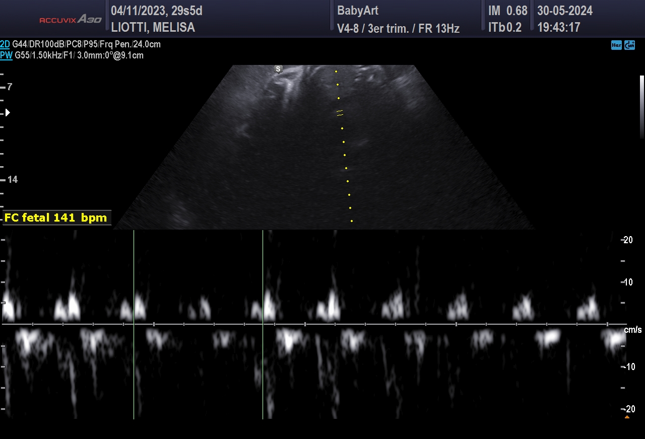 JULIA DE MELISA LIOTTI_0019.JPG